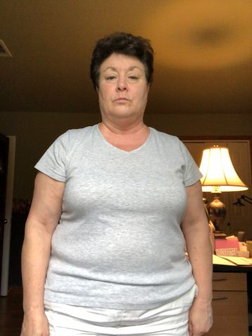 Christine I before